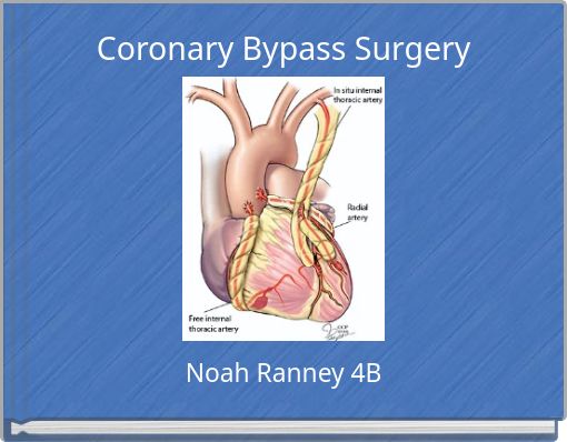 coronary-bypass-surgery-free-stories-online-create-books-for-kids